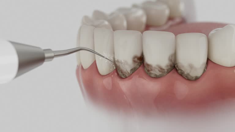 Trusted Tooth Extraction service in Laurinburg, NC - Dentist Open Now